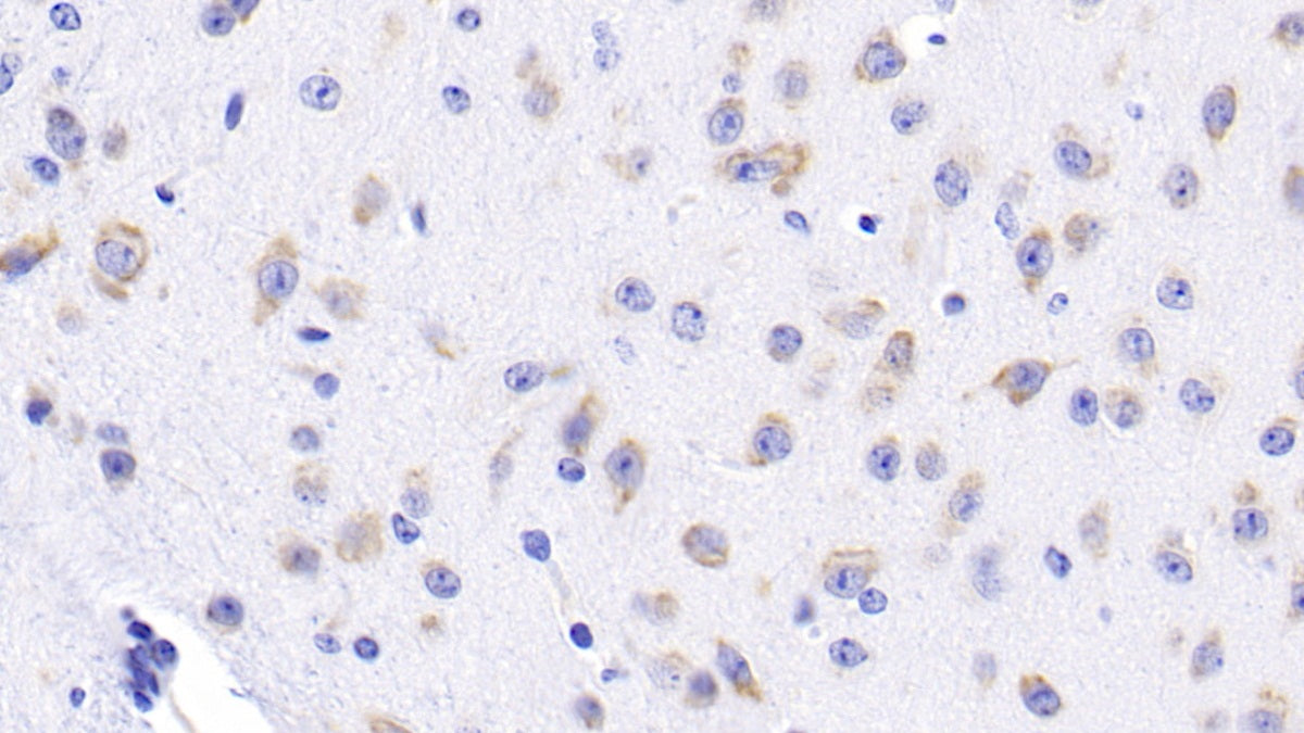 Western Blot; Sample: Lane1: Rat Liver lysate; Lane2: Rat Testis lysate; Lane3: A549 cell lysate Primary Ab: 2ug/ml Mouse Anti-Mouse HSPA5 Antibody Second Ab: 0.2ug/mL HRP-Linked Caprine Anti-Mouse IgG Polyclonal Antibody