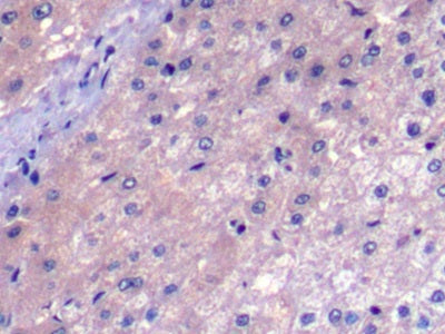 DAB staining on IHC-P; Sample: Human Stomach Tissue; Primary Ab: 10ug/ml Mouse Anti-Human aFP Antibody; Second Ab: 2ug/mL HRP-Linked Caprine Anti-Mouse IgG Polyclonal Antibody