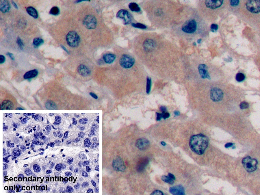 Alpha-Fetoprotein (AFP) Monoclonal Antibody - image 5