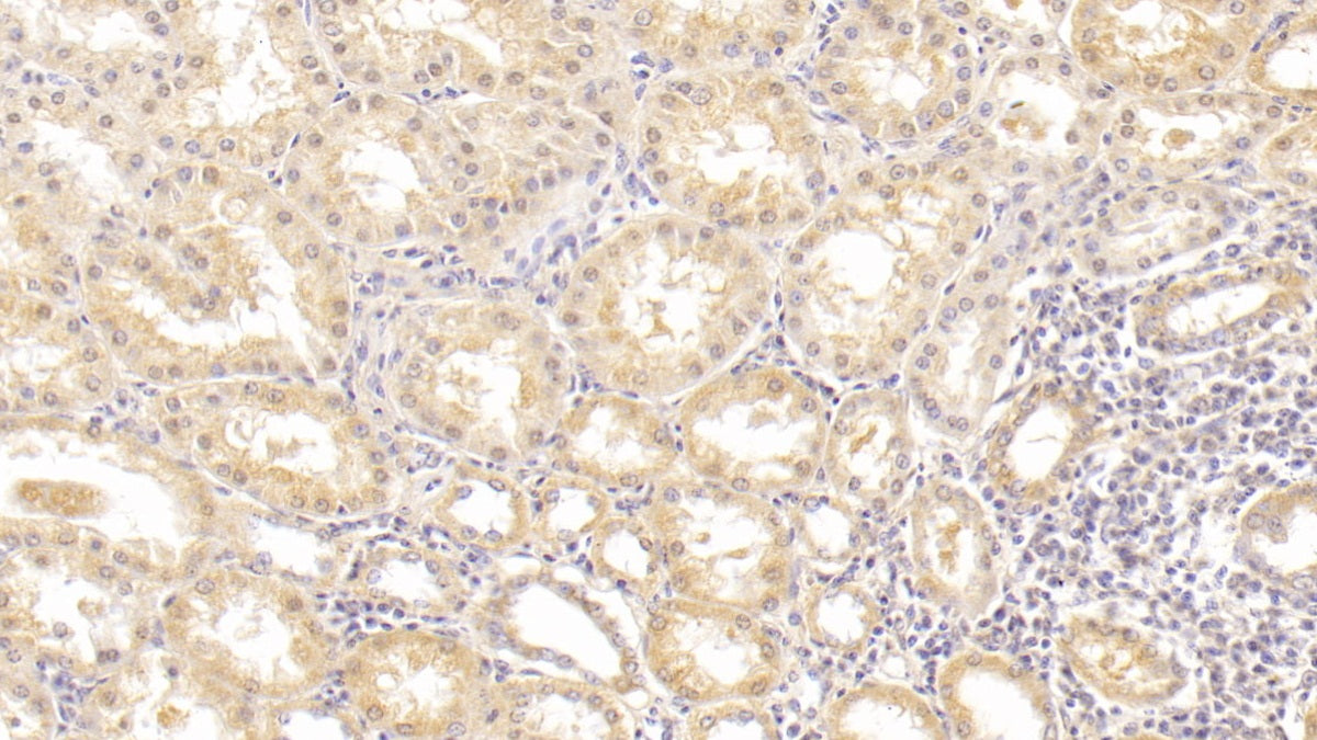 DAB staining on IHC-P; Sample: Human Liver Tissue; Primary Ab: 20ug/ml Mouse Anti-Human ALT Antibody; Second Ab: 2ug/mL HRP-Linked Caprine Anti-Mouse IgG Polyclonal Antibody
