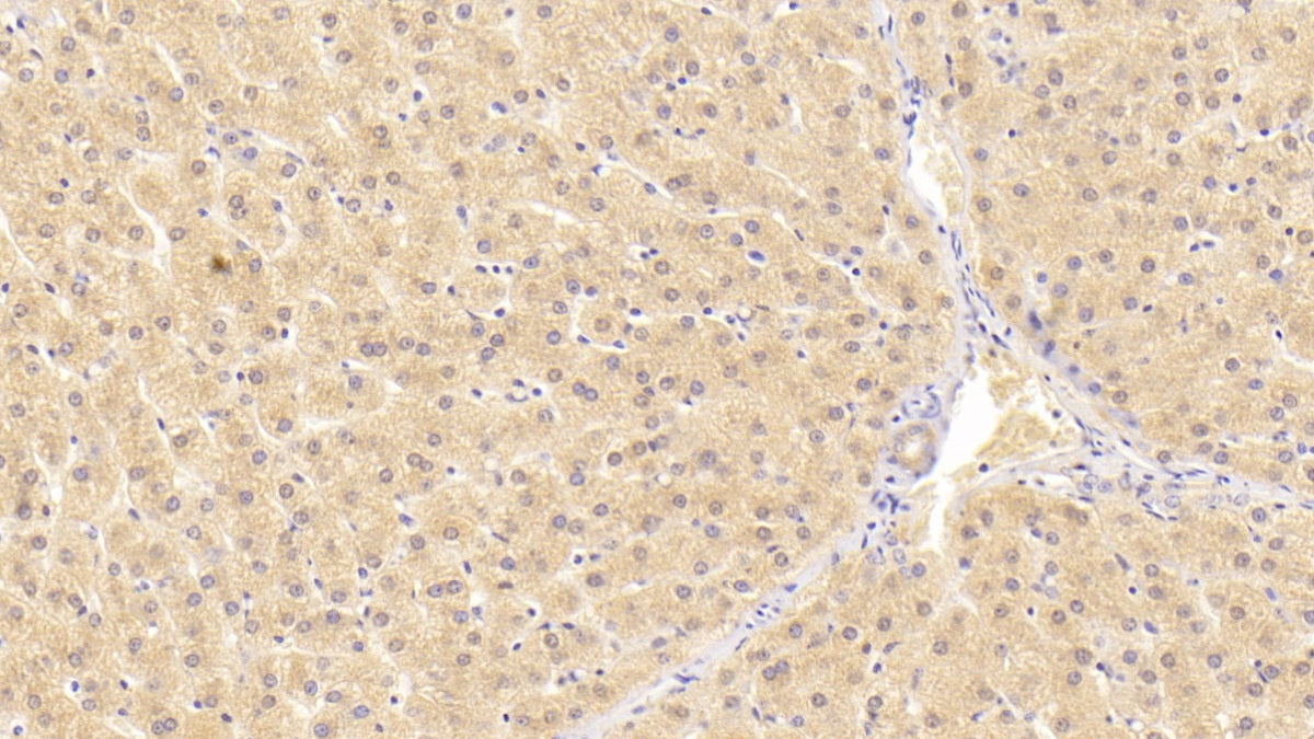 DAB staining on IHC-P; Sample: Human Skeletal muscle Tissue; Primary Ab: 20ug/ml Mouse Anti-Human ALT Antibody; Second Ab: 2ug/mL HRP-Linked Caprine Anti-Mouse IgG Polyclonal Antibody