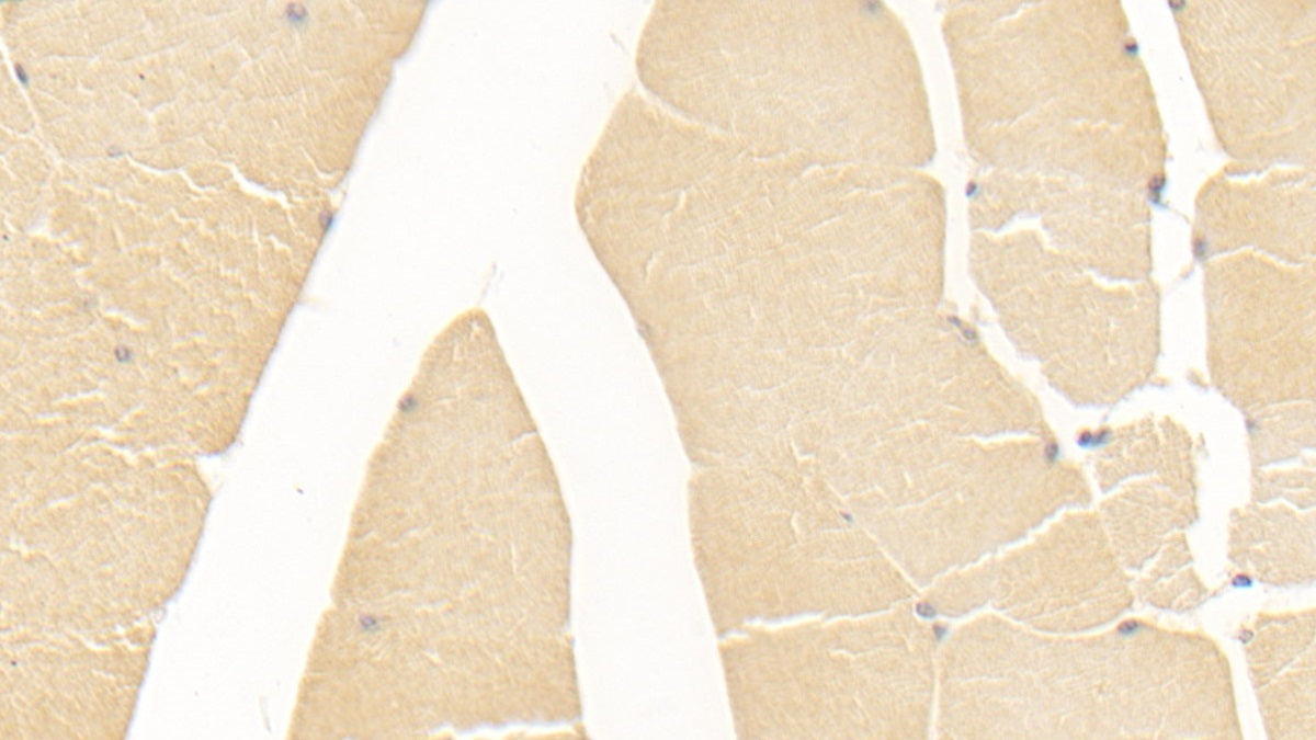 DAB staining on IHC-P; Sample: Human Liver Tissue; Primary Ab: 20ug/ml Mouse Anti-Human ALT Antibody; Control: Used PBS instead of primary antibody; Second Ab: 2ug/ml HRP-Linked Caprine Anti-Mouse IgG Polyclonal Antibody