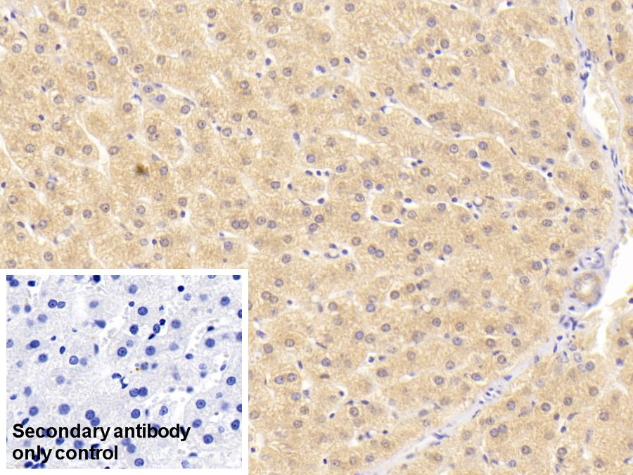 Alanine Aminotransferase (ALT) Monoclonal Antibody - image 5