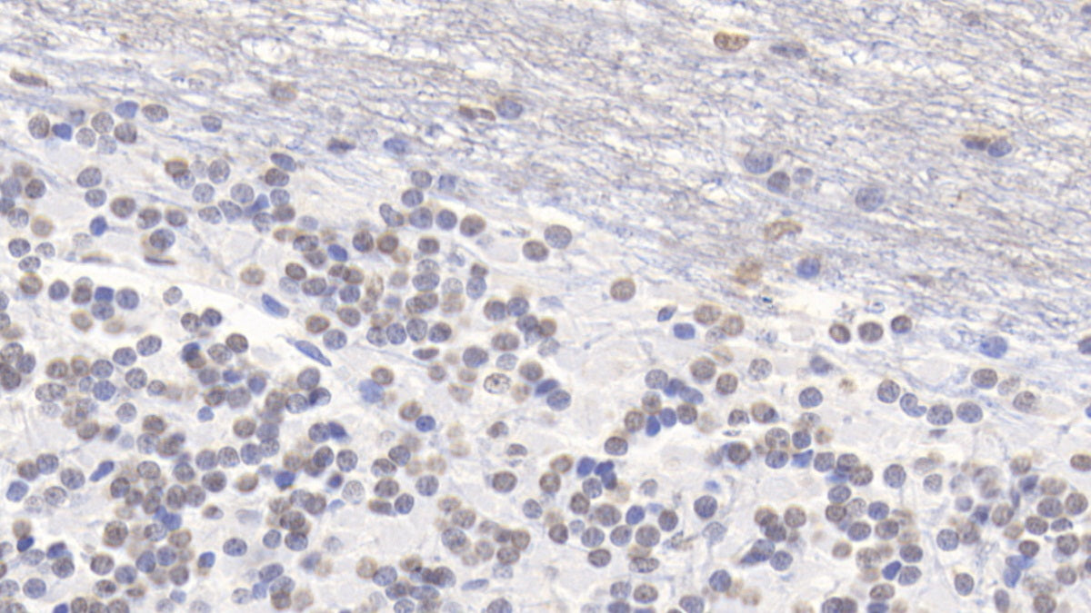 DAB staining on IHC-P; Sample: Human Cerebrum Tissue; Primary Ab: 20ug/ml Mouse Anti-Human S100B Antibody; Second Ab: 2ug/mL HRP-Linked Caprine Anti-Mouse IgG Polyclonal Antibody