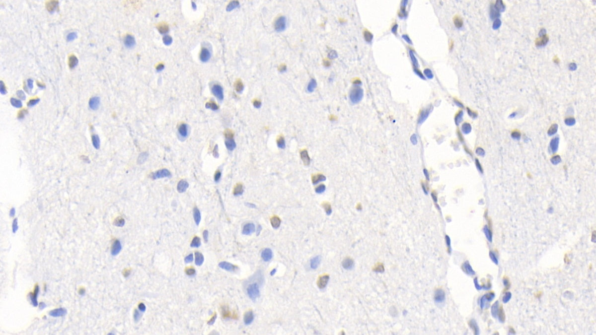 Western Blot; Sample: Rat Cerebrum lysate Primary Ab: 3ug/ml Mouse Anti-Human S100B Antibody Second Ab: 0.2ug/mL HRP-Linked Caprine Anti-Mouse IgG Polyclonal Antibody