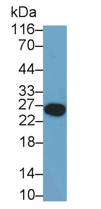 T-Cell Immunoreceptor With Ig And ITIM Domains Protein (TIGIT) Monoclonal Antibody - image 2