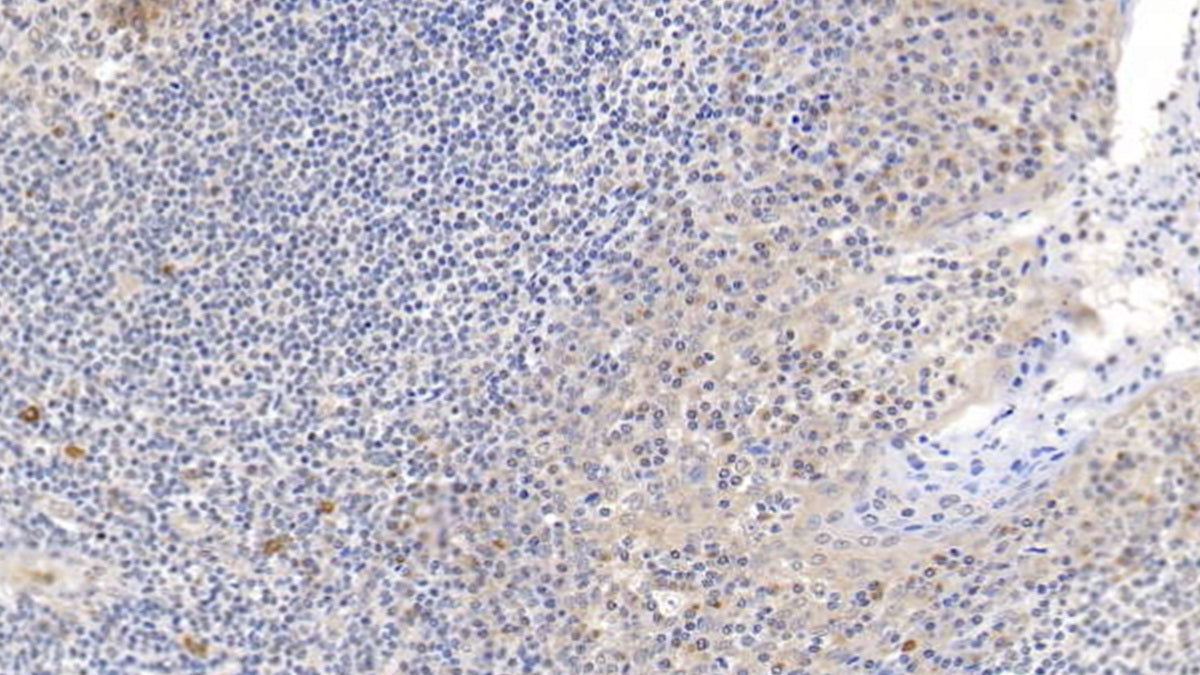 Western Blot; Sample: Lane1: Rat Kidney lysate; Lane2: Rat Uterus lysate; Lane3: Hela cell lysate; Lane4: Raji cell lysate Primary Ab: 1ug/ml Mouse Anti-Human SDC1 Antibody Second Ab: 0.2ug/mL HRP-Linked Caprine Anti-Mouse IgG Polyclonal Antibody