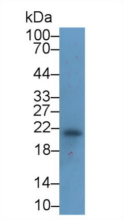 Ferritin, Heavy Polypeptide (FTH) Monoclonal Antibody - image 3
