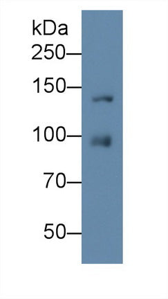Insulin Like Growth Factor 1 Receptor (IGF1R) Monoclonal Antibody - image 2