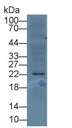 Deoxythymidylate Kinase (DTYMK) Monoclonal Antibody - image 4