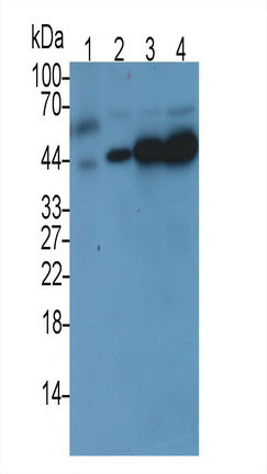 Western Blot; Sample: Lane1: Human Lung lysate; Lane2: 293T cell lysate; Lane3: Mouse Testis lysate; Lane4: Rat Kidney lysate; Lane5: Rat Testis lysate; Lane6: Cavia Testis lysate; Primary Ab: 1ug/ml Mouse Anti-Human TBP Antibody; Second Ab: 0.2ug/mL HRP-Linked Caprine Anti-Mouse IgG Polyclonal Antibody