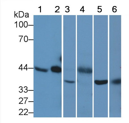 Western Blot; Sample: Lane1: Human Lung lysate; Lane2: 293T cell lysate; Lane3: Rat Testis lysate; Lane4: Porcine Kidney lysate; Lane5: Bovine Testis lysate; Primary Ab: 1ug/ml Mouse Anti-Human TBP Antibody; Second Ab: 0.2ug/mL HRP-Linked Caprine Anti-Mouse IgG Polyclonal Antibody