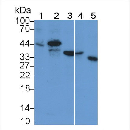 TATA Binding Protein (TBP) Monoclonal Antibody - image 5