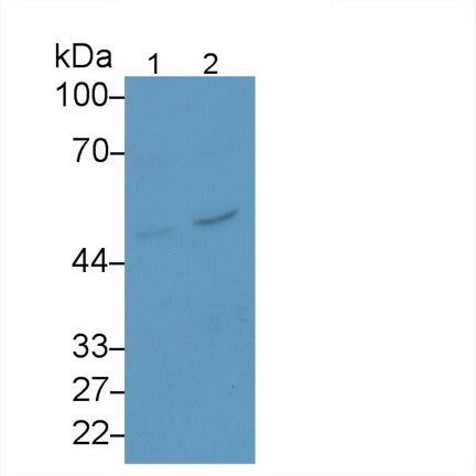 Serpin B3 (SERPINB3) Monoclonal Antibody - image 2