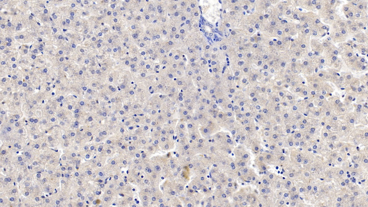 DAB staining on IHC-P; Sample: Human Skeletal muscle Tissue; Primary Ab: 10ug/ml Mouse Anti-Human TDO Antibody; Second Ab: 2ug/mL HRP-Linked Caprine Anti-Mouse IgG Polyclonal Antibody
