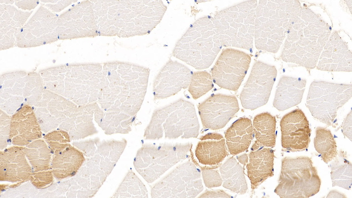 DAB staining on IHC-P; Sample: Human Liver Tissue; Primary Ab: 10ug/ml Mouse Anti-Human TDO Antibody; Control: Used PBS instead of primary antibody; Second Ab: 2ug/ml HRP-Linked Caprine Anti-Mouse IgG Polyclonal Antibody