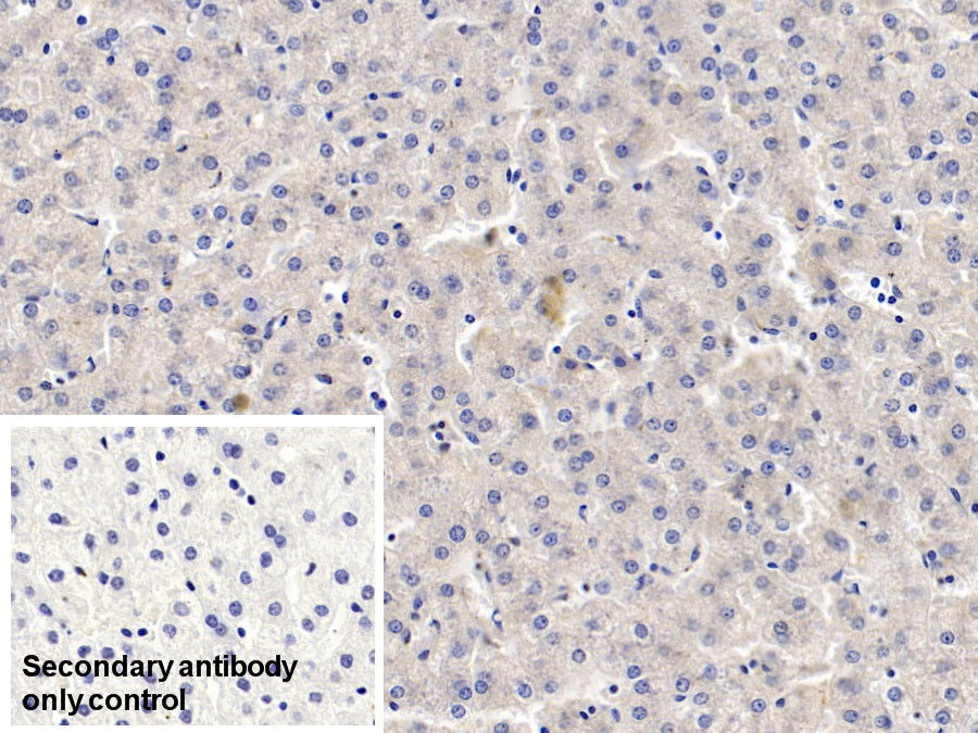 DAB staining on IHC-P; Sample: Human Skeletal muscle Tissue; Primary Ab: 10ug/ml Mouse Anti-Human TDO Antibody; Control: Used PBS instead of primary antibody; Second Ab: 2ug/ml HRP-Linked Caprine Anti-Mouse IgG Polyclonal Antibody