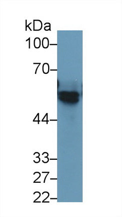 Western Blot; Sample: Rat Kidney lysate; Primary Ab: 3ug/ml Mouse Anti-Rat AGT Antibody; Second Ab: 0.2ug/mL HRP-Linked Caprine Anti-Mouse IgG Polyclonal Antibody