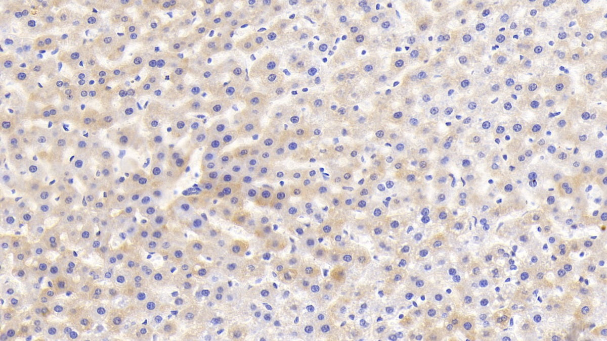 DAB staining on IHC-P; Sample: Rat Liver Tissue; Primary Ab: 30ug/ml Mouse Anti-Rat HRG Antibody; Control: Used PBS instead of primary antibody; Second Ab: 2ug/ml HRP-Linked Caprine Anti-Mouse IgG Polyclonal Antibody