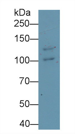 Desmoglein 3 (DSG3) Monoclonal Antibody - image 3