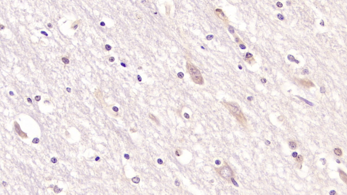Cluster Of Differentiation 97 (CD97) Monoclonal Antibody - image 2