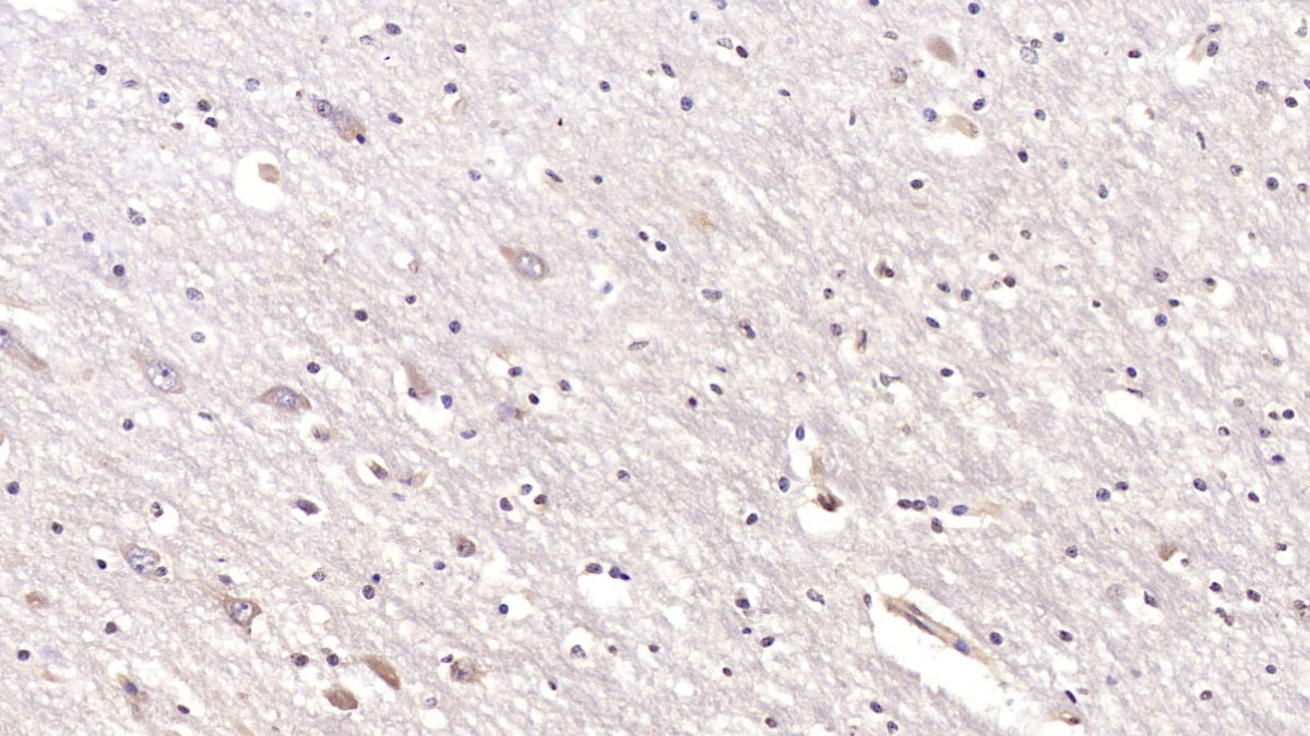 Cluster Of Differentiation 97 (CD97) Monoclonal Antibody - image 2