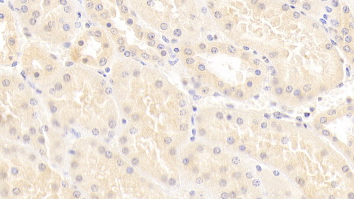 DAB staining on IHC-P; Sample: Human Colon Tissue; Primary Ab: 20ug/ml Mouse Anti-Human SCNN1g Antibody; Second Ab: 2ug/mL HRP-Linked Caprine Anti-Mouse IgG Polyclonal Antibody