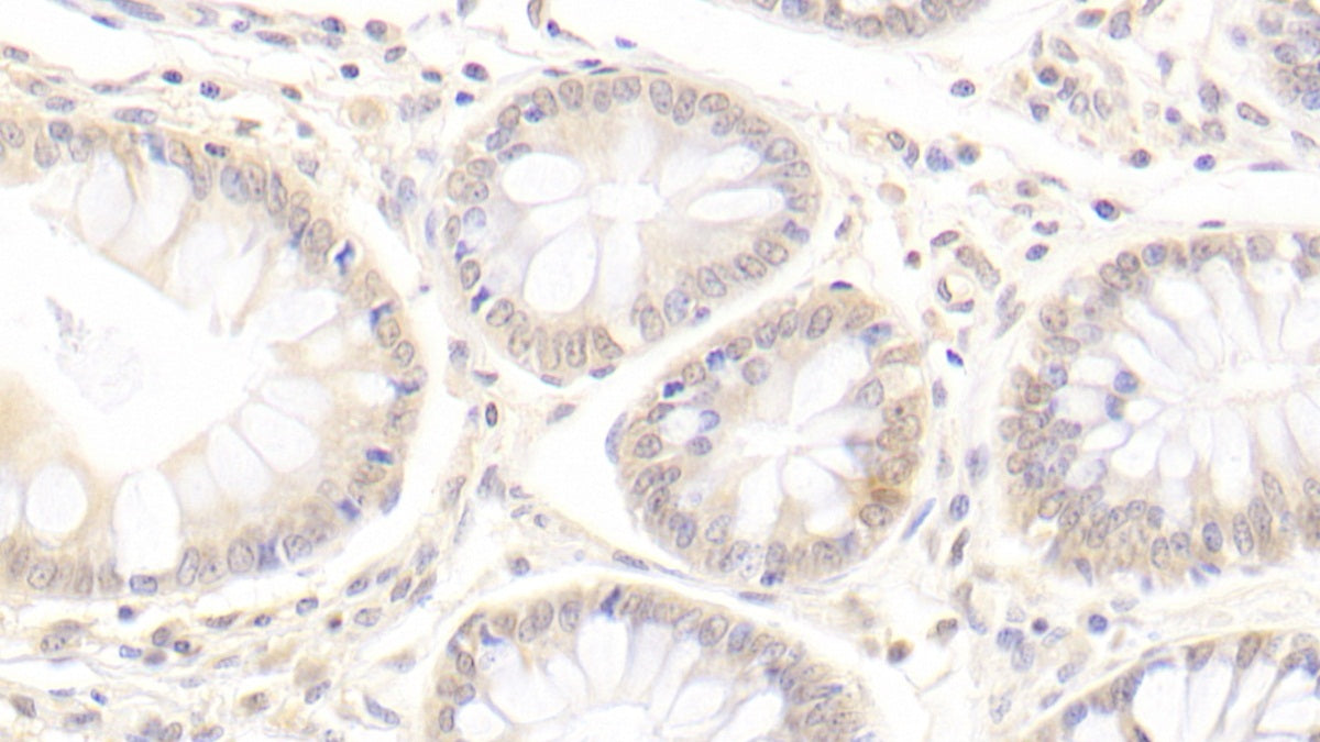 Amiloride Sensitive Sodium Channel Subunit Gamma (SCNN1g) Monoclonal Antibody - image 3
