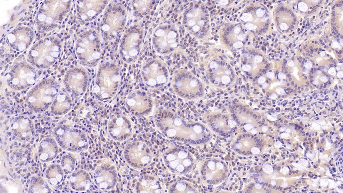DAB staining on IHC-P; Sample: Human Pancreas Tissue; Primary Ab: 40ug/ml Mouse Anti-Human ASPH Antibody; Second Ab: 2ug/mL HRP-Linked Caprine Anti-Mouse IgG Polyclonal Antibody