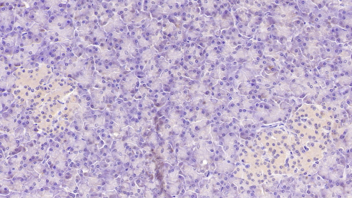 DAB staining on IHC-P; Sample: Human Kidney Tissue; Primary Ab: 40ug/ml Mouse Anti-Human ASPH Antibody; Second Ab: 2ug/mL HRP-Linked Caprine Anti-Mouse IgG Polyclonal Antibody