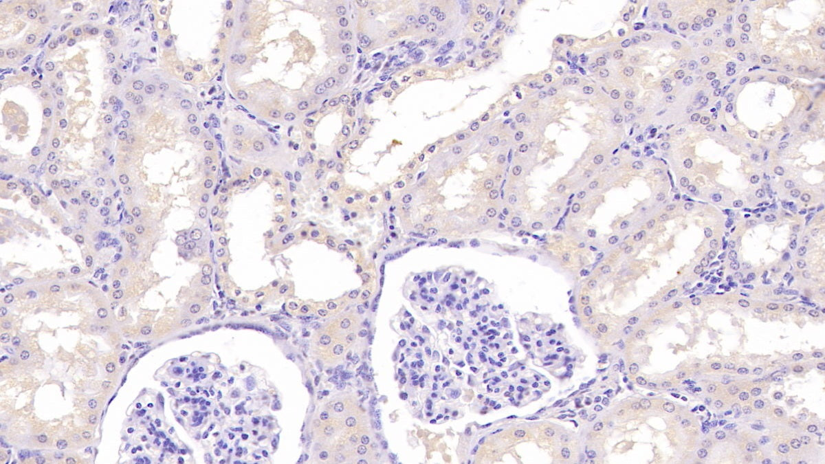 AF488 staining on IF; Sample: Hela cell; Primary Ab: 30ug/ml Mouse Anti-Human ASPH Antibody; Second Ab: 2ug/ml AF488-Linked Caprine Anti-Mouse IgG Polyclonal Antibody