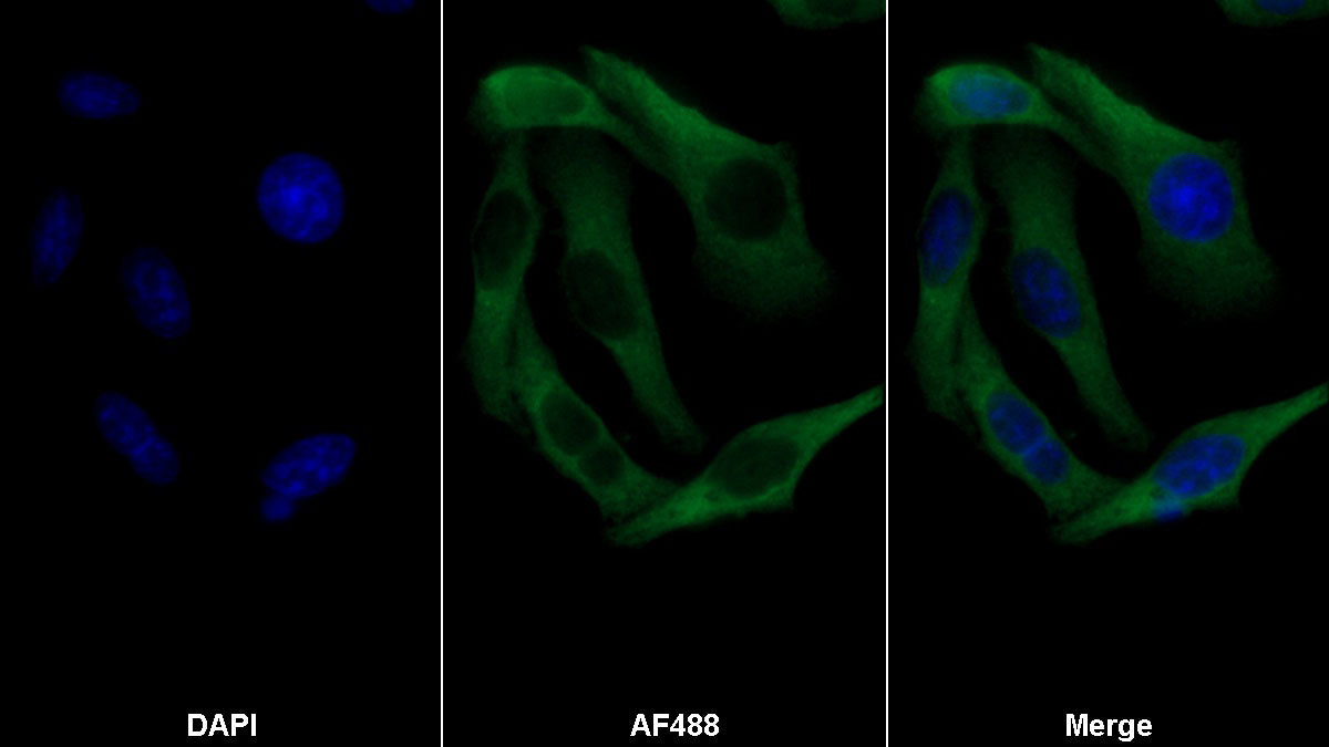 Aspartate Beta Hydroxylase (ASPH) Monoclonal Antibody - image 5