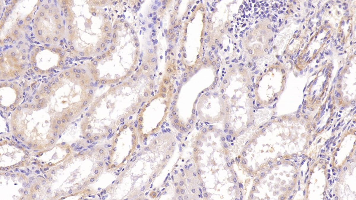 DAB staining on IHC-P; Sample: Human Pancreas Tissue; Primary Ab: 40ug/ml Mouse Anti-Human ASPH Antibody; Second Ab: 2ug/mL HRP-Linked Caprine Anti-Mouse IgG Polyclonal Antibody