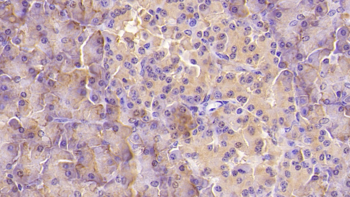 DAB staining on IHC-P; Sample: Human Small intestine Tissue; Primary Ab: 40ug/ml Mouse Anti-Human ASPH Antibody; Second Ab: 2ug/mL HRP-Linked Caprine Anti-Mouse IgG Polyclonal Antibody