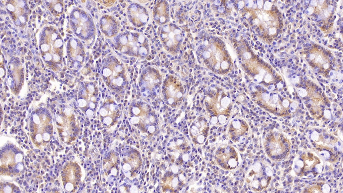 DAB staining on IHC-P; Sample: Human Cerebrum Tissue; Primary Ab: 40ug/ml Mouse Anti-Human ASPH Antibody; Second Ab: 2ug/mL HRP-Linked Caprine Anti-Mouse IgG Polyclonal Antibody