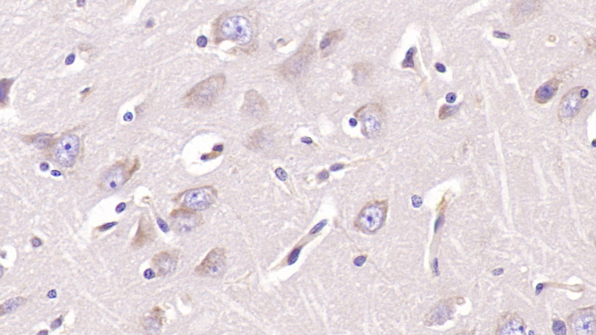 Aspartate Beta Hydroxylase (ASPH) Monoclonal Antibody - image 5