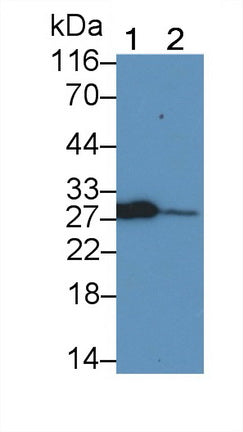 Programmed Cell Death Protein 1 (PD1) Monoclonal Antibody - image 2