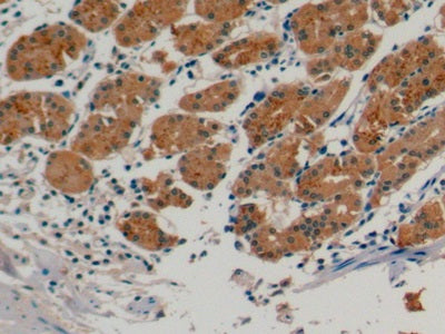 Urocortin 2 (UCN2) Monoclonal Antibody - image 3