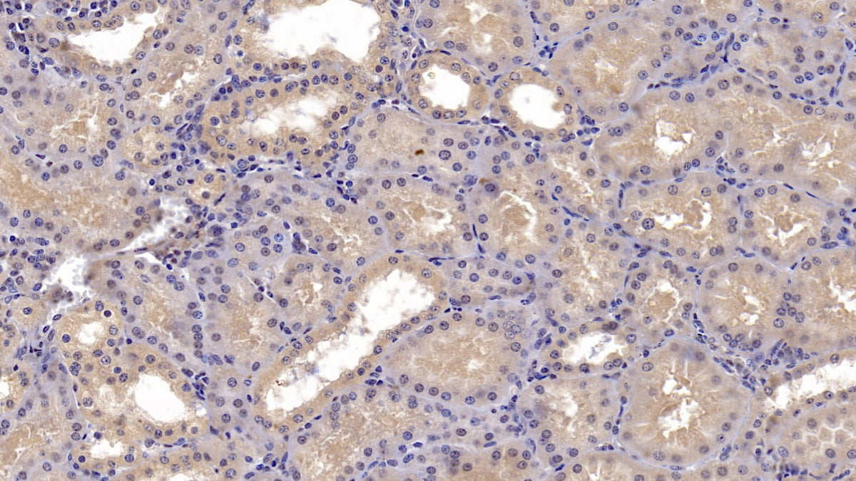 DAB staining on IHC-P; Sample: Human Small intestine Tissue; Primary Ab: 10ug/ml Mouse Anti-Human CD73 Antibody; Second Ab: 2ug/mL HRP-Linked Caprine Anti-Mouse IgG Polyclonal Antibody
