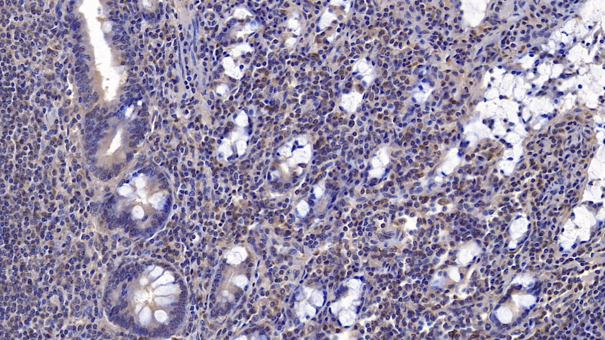 DAB staining on IHC-P; Sample: Human Liver Tissue; Primary Ab: 10ug/ml Mouse Anti-Human CD73 Antibody; Second Ab: 2ug/mL HRP-Linked Caprine Anti-Mouse IgG Polyclonal Antibody