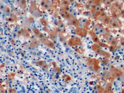 DAB staining on IHC-P; Sample: Human Liver Tissue; Primary Ab: 10ug/ml Mouse Anti-Human Arg Antibody; Control: Used PBS instead of primary antibody; Second Ab: 2ug/ml HRP-Linked Caprine Anti-Mouse IgG Polyclonal Antibody