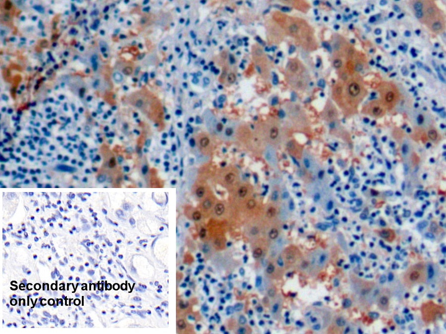 Arginase (ARG) Monoclonal Antibody - image 5