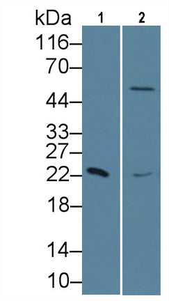 Retinol Binding Protein 4 (RBP4) Monoclonal Antibody - image 3