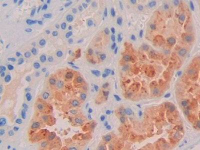 Western Blot Sample: Human Serum Primary Ab: 1ug/ml Mouse Anti-Human RBP4 Antibody Second Ab: 0.2ug/mL HRP-Linked Caprine Anti-Mouse IgG Polyclonal Antibody