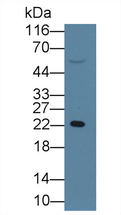 Western Blot; Sample: Human Urine; Primary Ab: 0.1ug/ml Mouse Anti-Human RBP4 Antibody; Second Ab: 0.2ug/ml HRP-Linked Caprine Anti-Mouse IgG Polyclonal Antibody