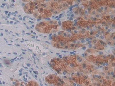 DAB staining on IHC-P; Sample: Rat Kidney Tissue; Primary Ab: 30ug/ml Mouse Anti-Rat CTGF Antibody; Second Ab: 2ug/mL HRP-Linked Caprine Anti-Mouse IgG Polyclonal Antibody