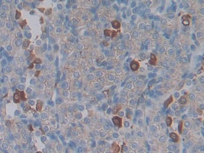 DAB staining on IHC-P; Sample: Rat Spleen Tissue; Primary Ab: 30ug/ml Mouse Anti-Rat CTGF Antibody; Second Ab: 2ug/mL HRP-Linked Caprine Anti-Mouse IgG Polyclonal Antibody