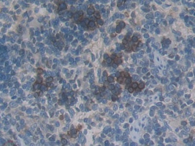 DAB staining on IHC-P; Sample: Rat Pancreas Tissue; Primary Ab: 30ug/ml Mouse Anti-Rat CTGF Antibody; Second Ab: 2ug/mL HRP-Linked Caprine Anti-Mouse IgG Polyclonal Antibody