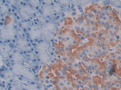 Connective Tissue Growth Factor (CTGF) Monoclonal Antibody - image 5