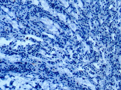 Western Blot; Sample: Lane1: Human Lung lysate; Lane2: K562 cell lysate; Lane3: Hela cell lysate; Lane4: HepG2 cell lysate; Primary Ab: 3ug/ml Mouse Anti-Rat ANXA1 Antibody Second Ab: 0.2ug/mL HRP-Linked Caprine Anti-Mouse IgG Polyclonal Antibody